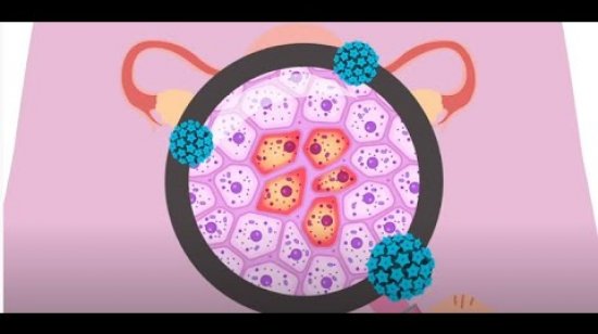 Embedded thumbnail for What is HPV?
