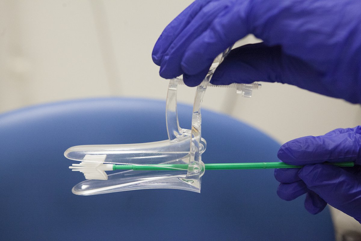 A gloved hand holding a speculum and brush used in cervical screening.