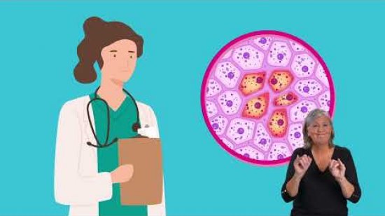 Embedded thumbnail for What is cervical cancer? BSL