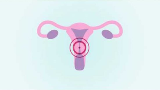 Embedded thumbnail for The facts about HPV (without subtitles)