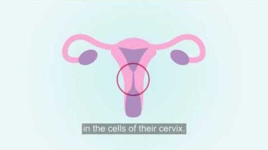 Embedded thumbnail for The facts about HPV (subtitles)