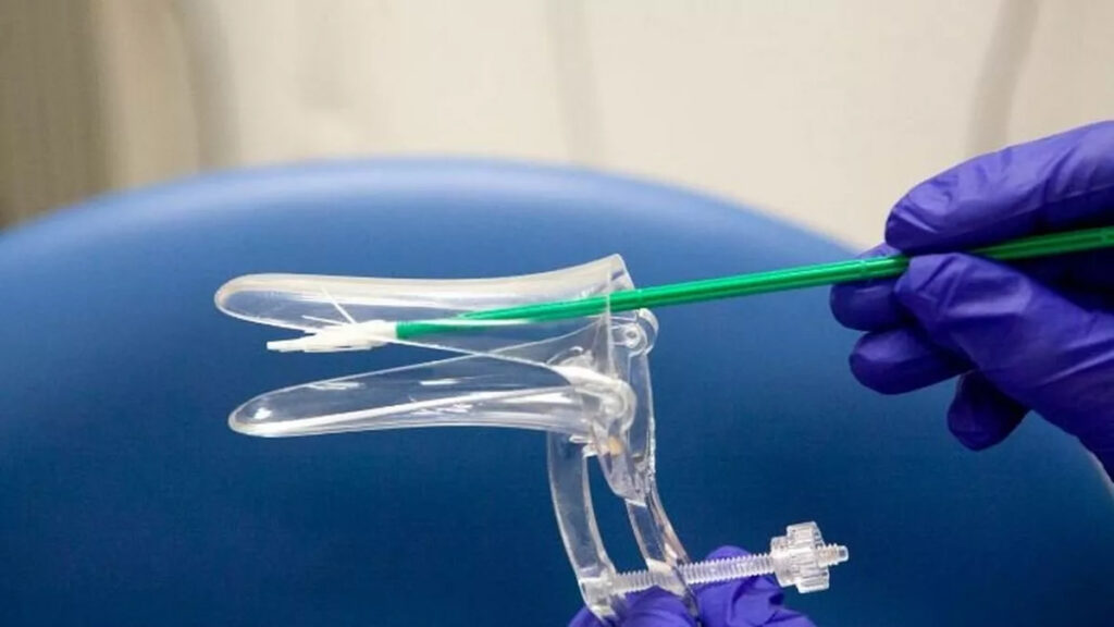 Explore what cervical screening is